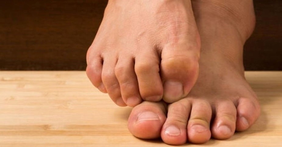 Tırnak mantarı diyabet hastalarında enfeksiyona davetiye çıkarıyor! 